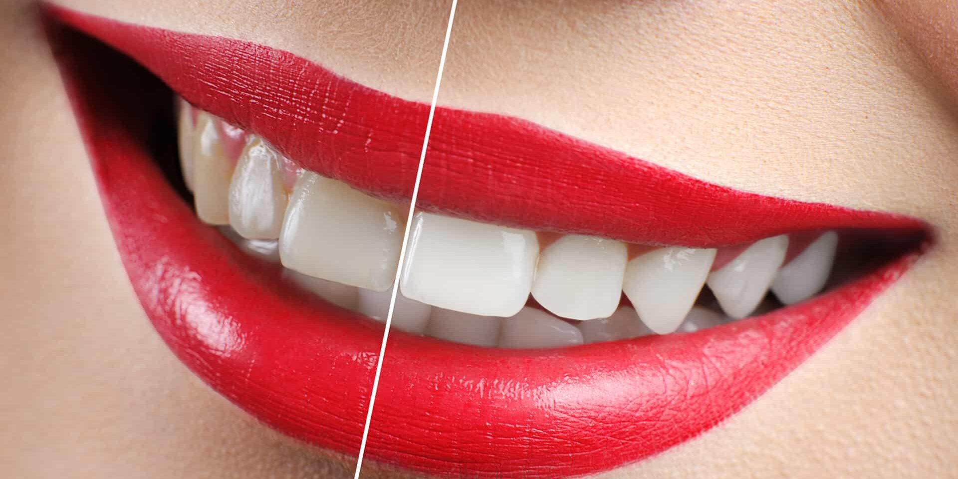Innovations in Cosmetic Dentistry Enhancing Your Smile Innovations in Cosmetic Dentistry: Enhancing Your Smile
