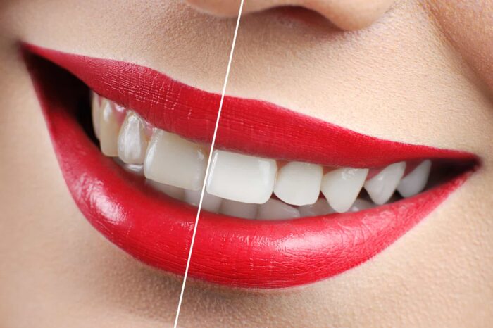 Innovations in Cosmetic Dentistry: Enhancing Your Smile