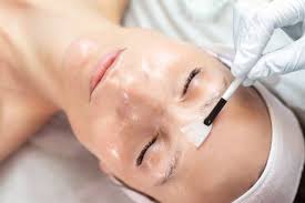 The Benefits of Chemical Peels for a Healthy Complexion