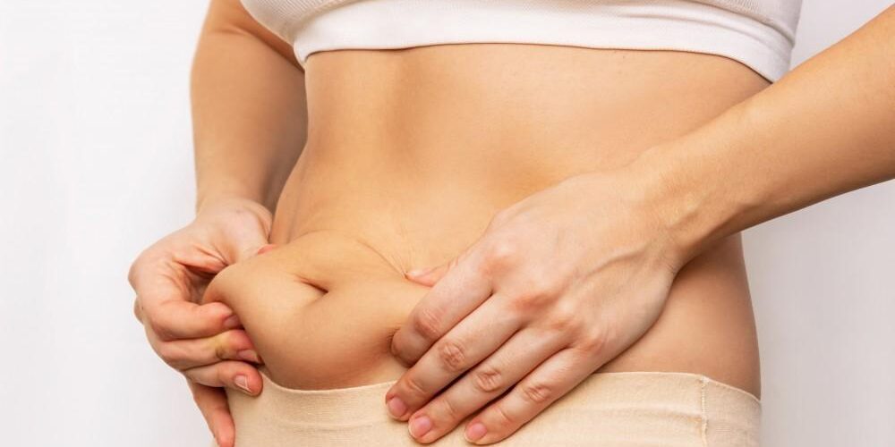 The Connection Between PCOS Symptoms and Weight Gain
