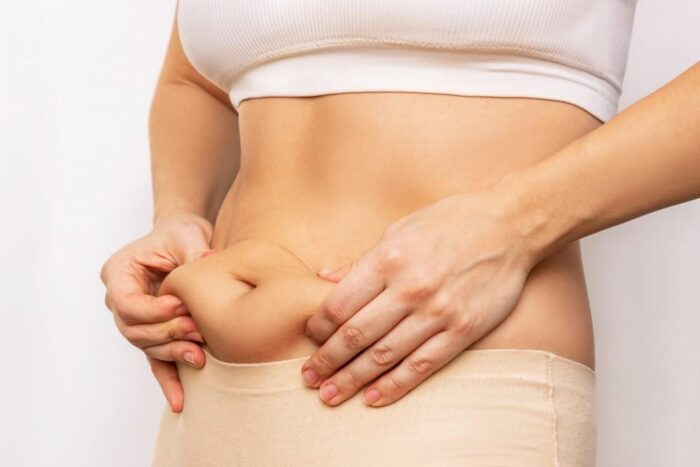 The Connection Between PCOS Symptoms and Weight Gain