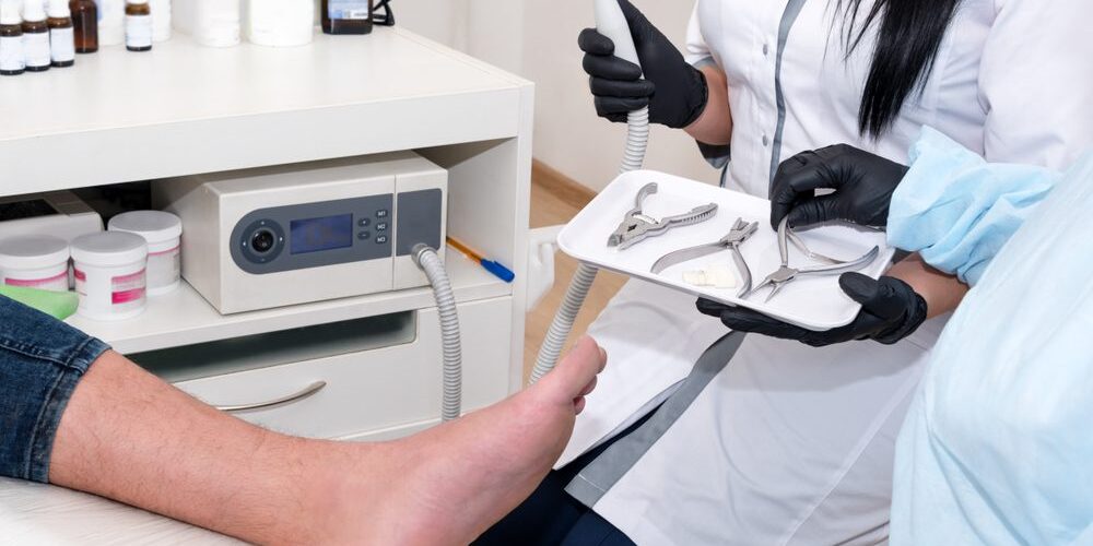 What to Expect When Recovering from Ingrown Toenail Surgery What to Expect When Recovering from Ingrown Toenail Surgery