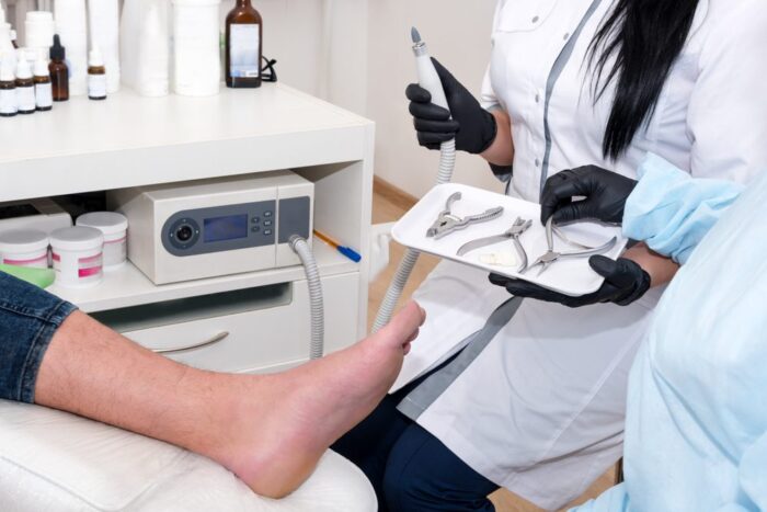 What to Expect When Recovering from Ingrown Toenail Surgery What to Expect When Recovering from Ingrown Toenail Surgery
