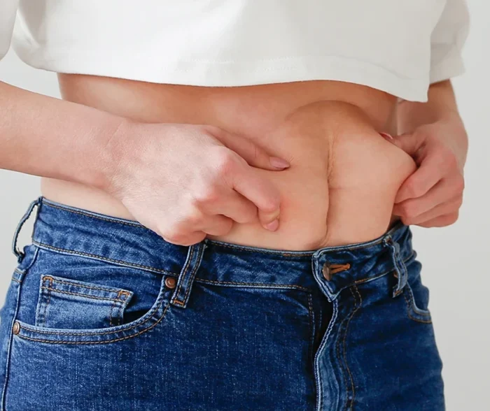 How Excess Skin Removal Surgery Can Transform Your Body Post-Bariatric