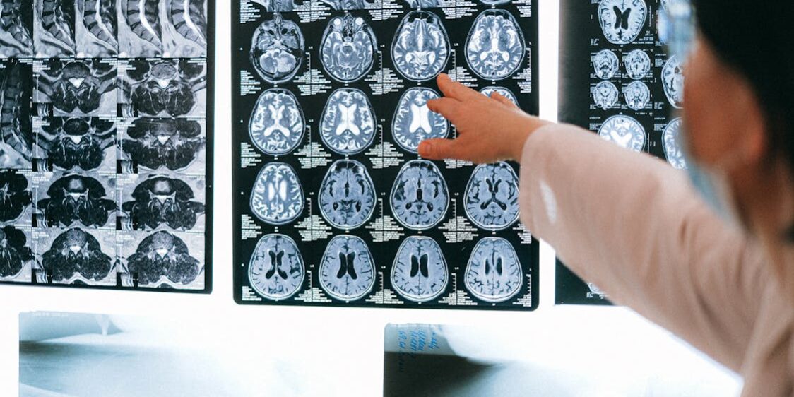 How MRI Technology Is Revolutionizing Brain Imaging How MRI Technology Is Revolutionizing Brain Imaging