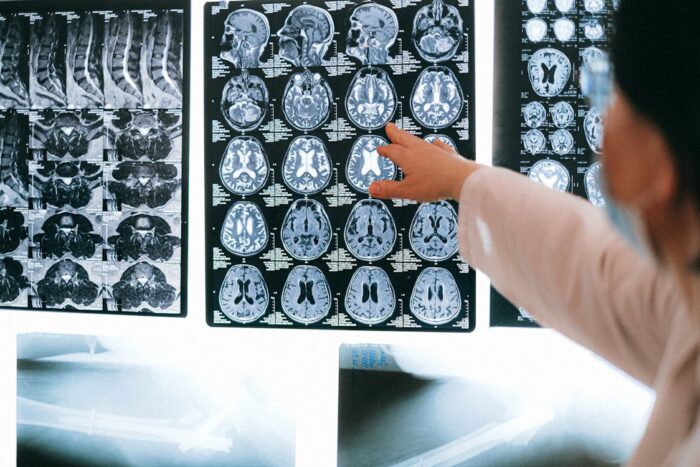 How MRI Technology Is Revolutionizing Brain Imaging