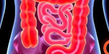 The Role of Colonoscopy in Colorectal Cancer Prevention The Role of Colonoscopy in Colorectal Cancer Prevention