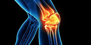 Understanding the Connection Between Joint Pain and Arthritis