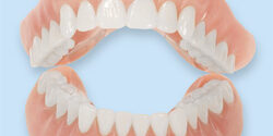 Understanding the Different Types of Dentures Available Understanding the Different Types of Dentures Available