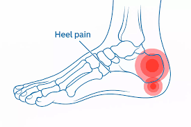 Understanding the Different Types of Heel Pain and Their Causes