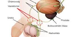 Understanding the Vasectomy Procedure and Recovery Understanding the Vasectomy Procedure and Recovery