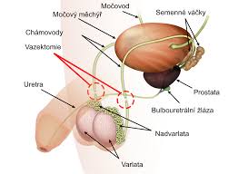 Understanding the Vasectomy Procedure and Recovery