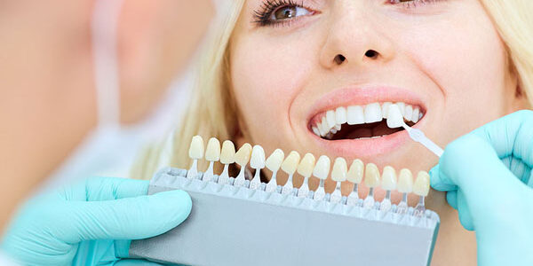 Who Can Benefit From Veneers Who Can Benefit From Veneers?