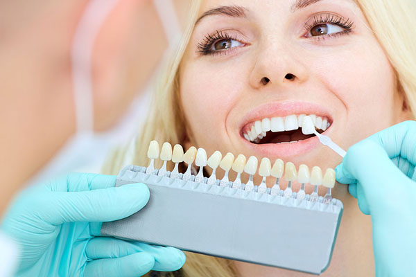 Who Can Benefit From Veneers?
