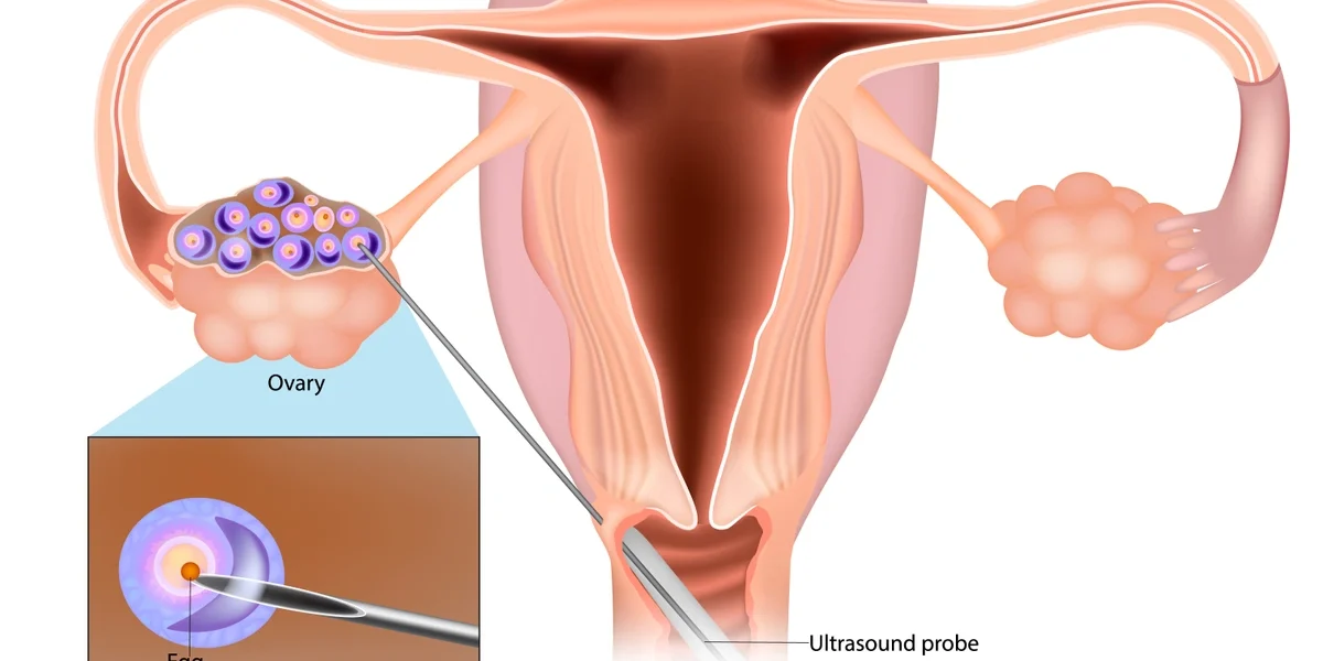 Understanding How Egg Freezing Works During IVF Understanding How Egg Freezing Works During IVF