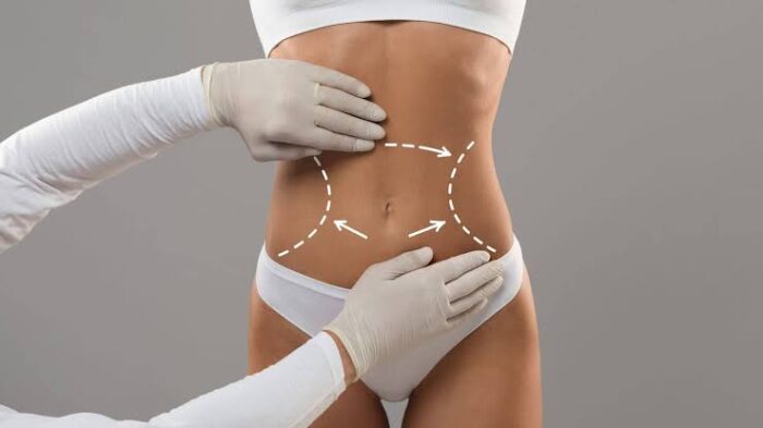 A Guide to Weight Loss Surgery for Different Body Types