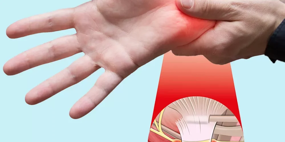 Identifying the Signs and Symptoms of Carpal Tunnel Syndrome