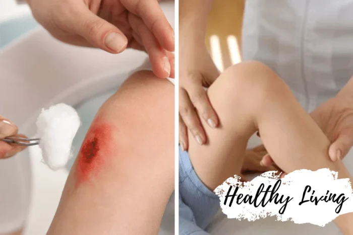 The Benefits of Regular Monitoring in Wound Care Management