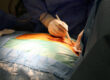 The Recovery Process After Hernia Surgery