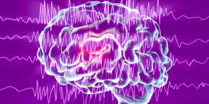The Role of Neurologists in Managing Epilepsy The Role of Neurologists in Managing Epilepsy