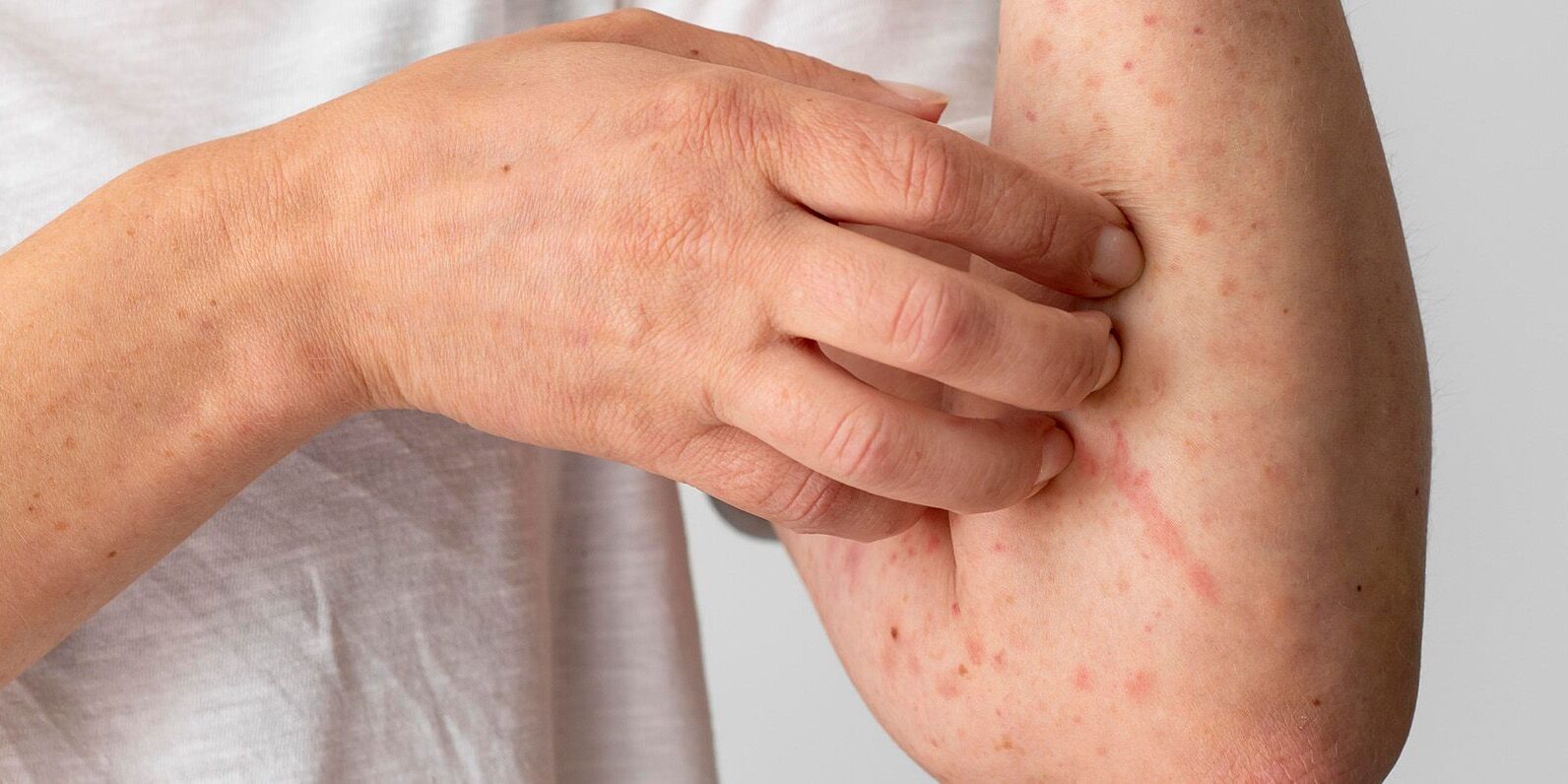 Understanding Allergy Testing Types and What To Expect Understanding Allergy Testing Types and What To Expect