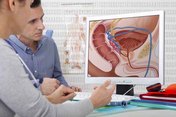 Understanding Prostate Cancer Understanding Prostate Cancer