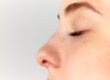 Understanding the Benefits of Balloon Sinuplasty for Chronic Sinusitis
