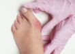 Understanding the Role of Genetics in Bunions