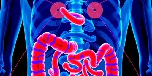 Understanding the Stages of Colon Cancer