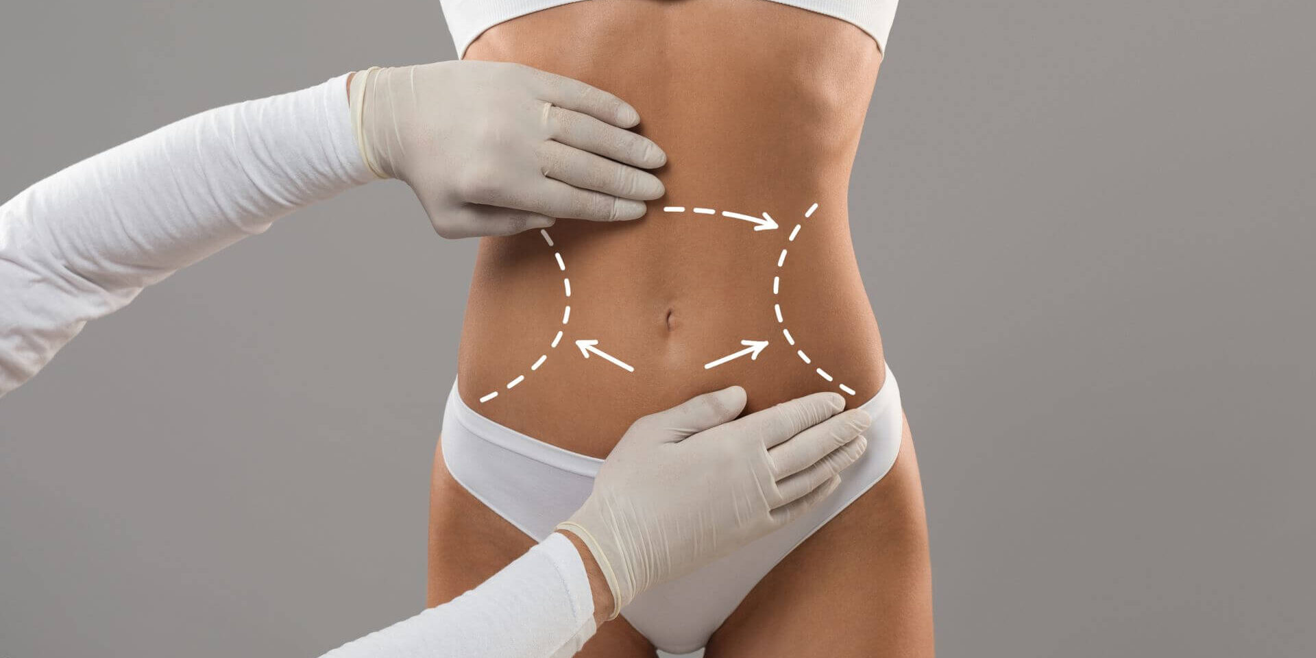 What To Know About Body Contouring What To Know About Body Contouring