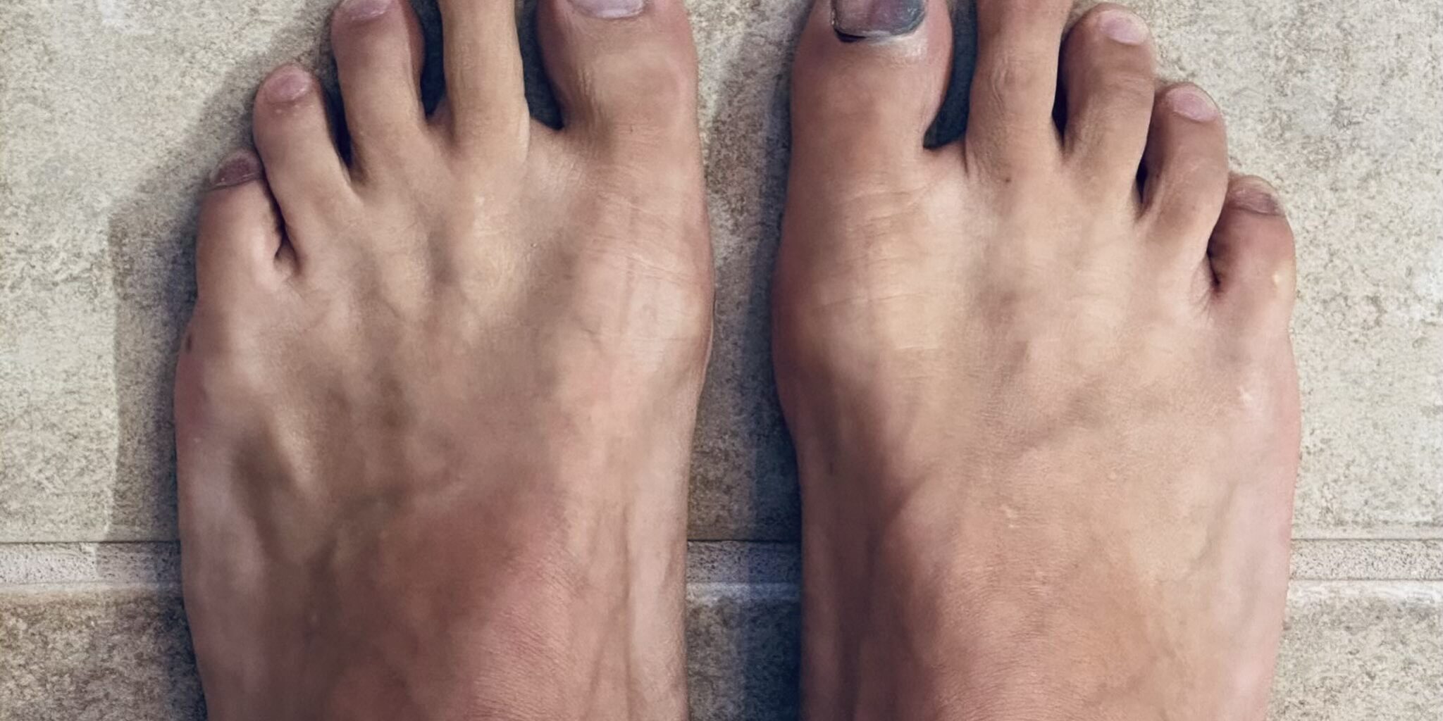 Foot Care Tips for Runners
