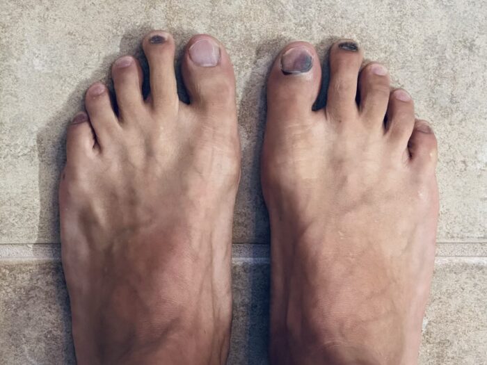 Foot Care Tips for Runners