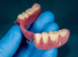 Maintaining Your Partial Dentures for Optimal Longevity