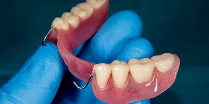 Maintaining Your Partial Dentures for Optimal Longevity