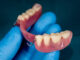 Maintaining Your Partial Dentures for Optimal Longevity