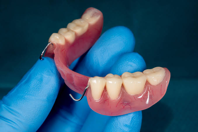 Maintaining Your Partial Dentures for Optimal Longevity
