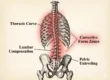 The Benefits of Early Diagnosis by a Scoliosis Specialist