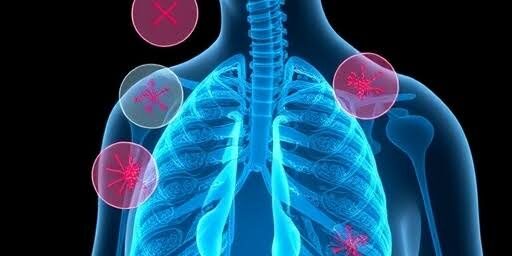Understanding What Asthma Is
