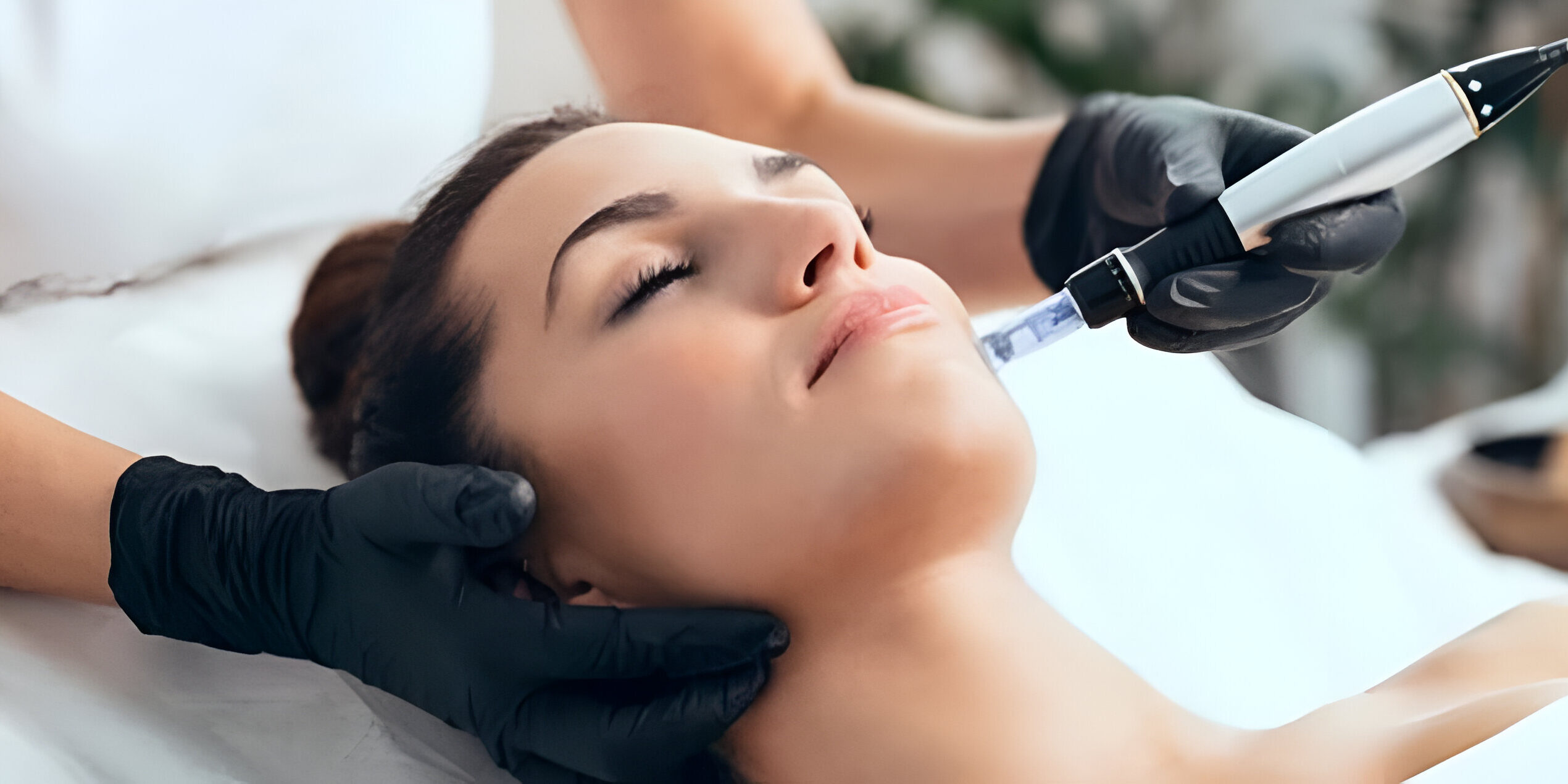 Who Should Get Microneedling Done Who Should Get Microneedling Done?